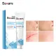 20g scar remover used for old scars on body scars scars burns and scalds new scars to remove scars without leaving scars scar remover elastic scar remover scar remover. 