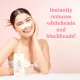 Hello Glow Nose Strips (Blackheads, Whiteheads Removal). 