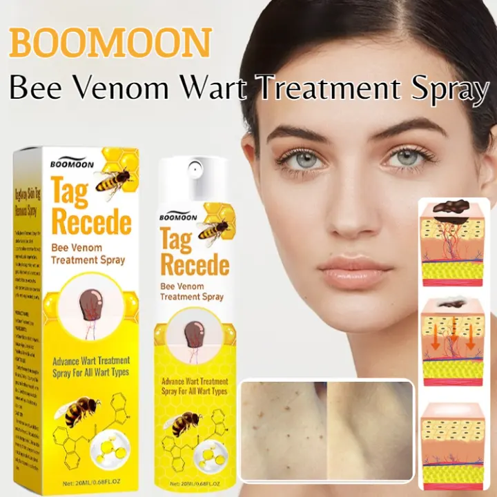 BOOMOON Bee Venom Wart Spray Wart Cream Mole remover cream Warts Skin Tags Remover