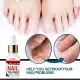 Repair Nail Smoothing Essence Onychomycosis Solution To Solve The Nail Fungus Problem On Toenails And Fingernails 50ml. 