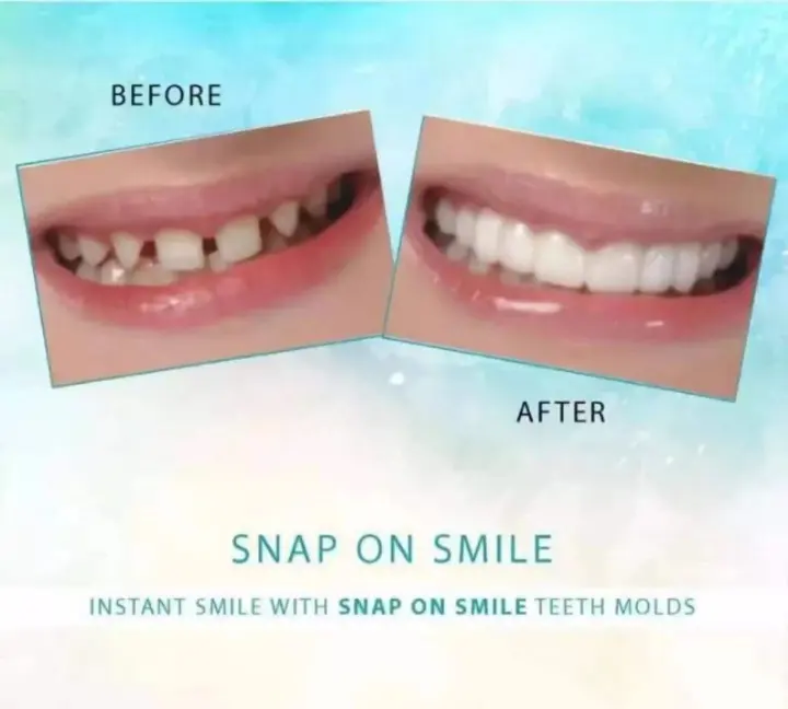 Snap On Smile Teeth One Size Fits Snapon Snap-on Smile