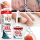 Repair Nail Smoothing Essence Onychomycosis Solution To Solve The Nail Fungus Problem On Toenails And Fingernails 50ml. 
