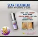 Erase Scar Removing Solution 7ml Scar removing medicine Blocked nose. 