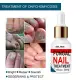 Repair Nail Smoothing Essence Onychomycosis Solution To Solve The Nail Fungus Problem On Toenails And Fingernails 50ml. 