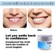 SWEETRIP 【Fast filling】Temporary Tooth Repair kit 50g Artificial temporary tooth teeth Teeth And Gaps FalseTeeth Solid Glue Denture Adhesive Glue Decorative Denture Tooth Repair Glue Moldable False Teeth DIY Tooth Repair Kit. 