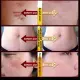 20g scar remover used for old scars on body scars scars burns and scalds new scars to remove scars without leaving scars scar remover elastic scar remover scar remover. 