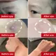 20g scar remover used for old scars on body scars scars burns and scalds new scars to remove scars without leaving scars scar remover elastic scar remover scar remover. 