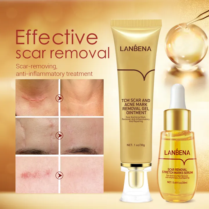 LANBENA Acne Scar Remove Set Scar Removal Serum Acne Pimeple Marks  Treatment Cream Skin Repair Stretch Marks Removal Gel Scar on Legs Remover  2PCS | Lazada PH