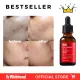 By Wishtrend Pure Vitamin C 21.5 Advanced Serum. 