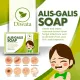 Diwata Alis Galis  Fast reliever of itchy skin due to Fungi at kati kati sa katawan  Remedy Hypo Allergenic Dermatitis. 