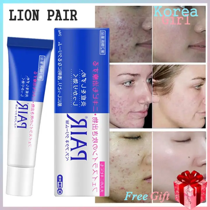 Lion Pair Japan Acne Cream Scar Removal Face Cream Skin Care 24g Japan Lion Pair Ance Medicated Acne Care Cream Lazada Ph