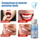 10g Temporary Tooth Repair Kit Teeth And Gaps FalseTeeth Solid Glue Denture Adhesive Glue. 